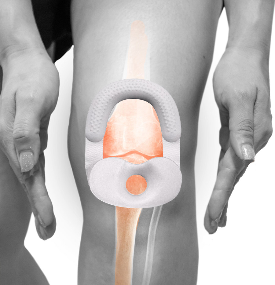Knestøtte MB Schlatter 