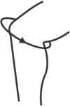 Stabiliserende kneortose Genum CRX LIGHT_size-guide
