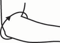 Spenne til tennisalbue - EpiCon _size-guide