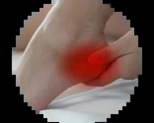 Hælspore Hælspore