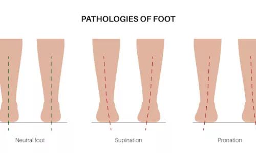 Pathologies of foot