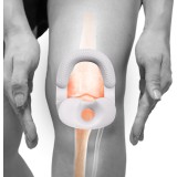 Knepute MB Schlatter (Small)